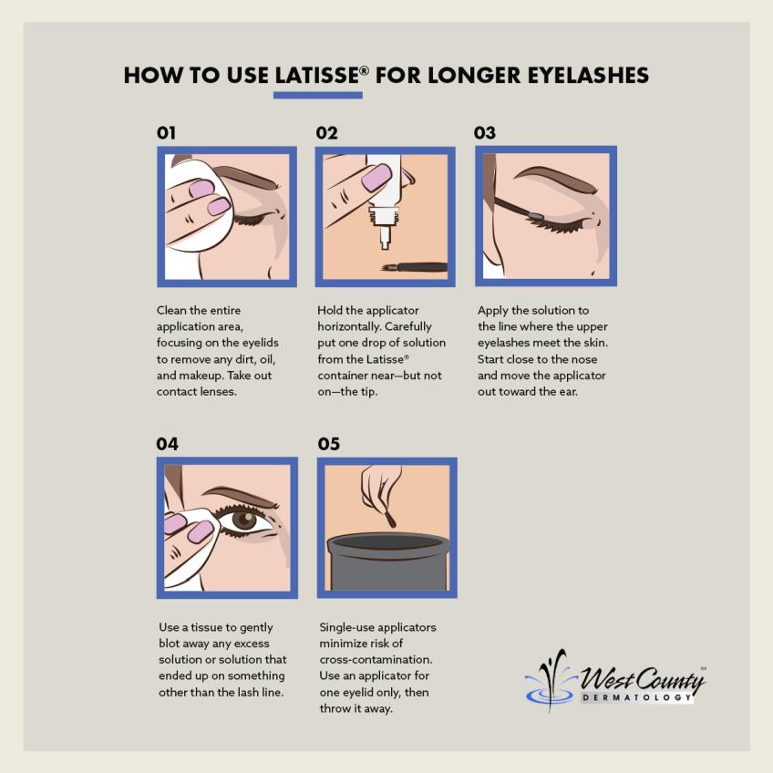 Follow a few simple steps to get the most out of eyelash-enhancing Latisse®, available at Chesterfield's West County Dermatology. Follow a few simple steps to get the most out of eyelash-enhancing Latisse®, available at Chesterfield's West County Dermatology.