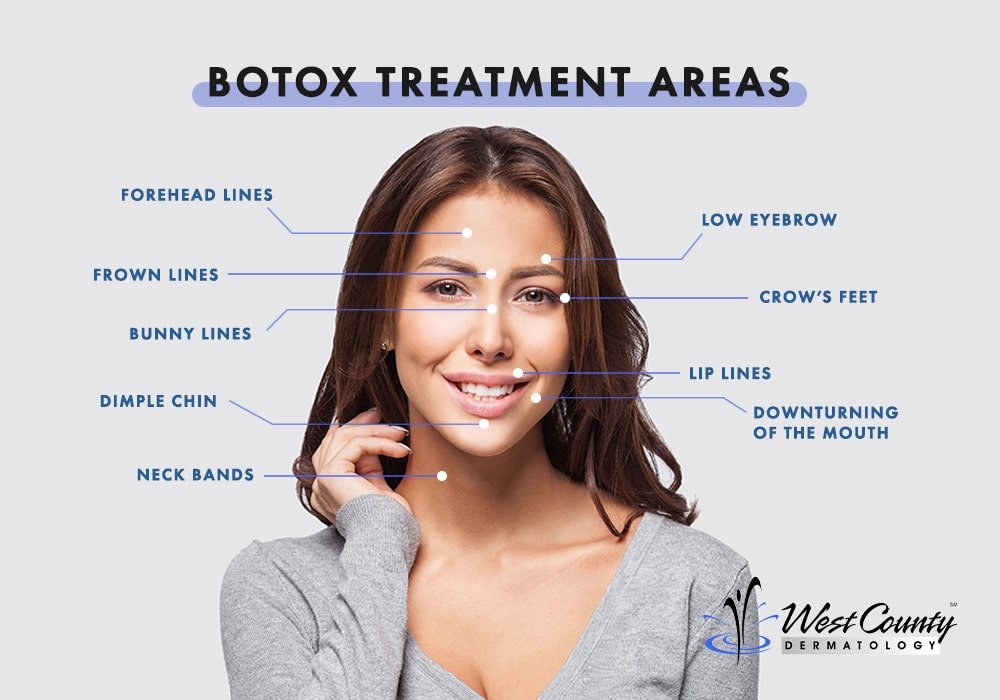 BOTOX ® Treatment Chesterfield, MO - West County Dermatology